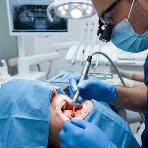 השתלות שיניים