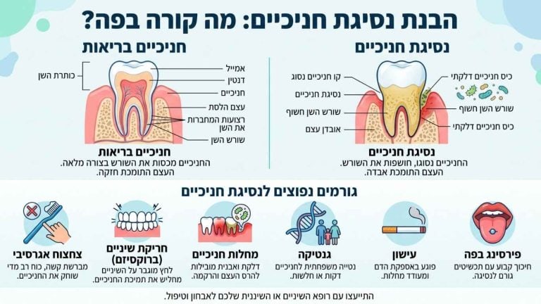 נסיגת חניכיים